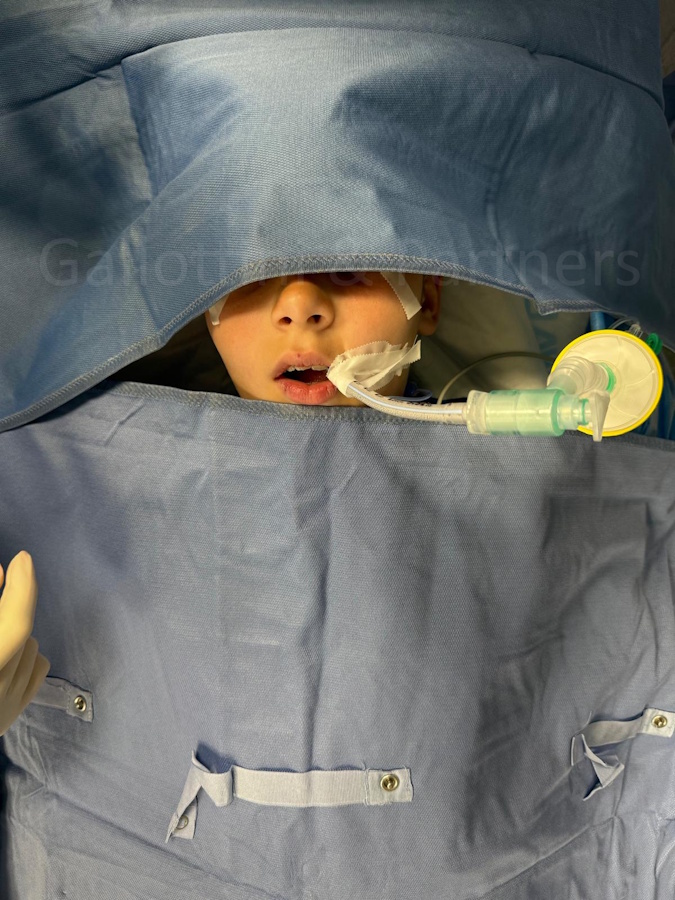 Cure Dentali per Bambini in Sala Operatoria Cure Dentali per Bambini in Sala Operatoria