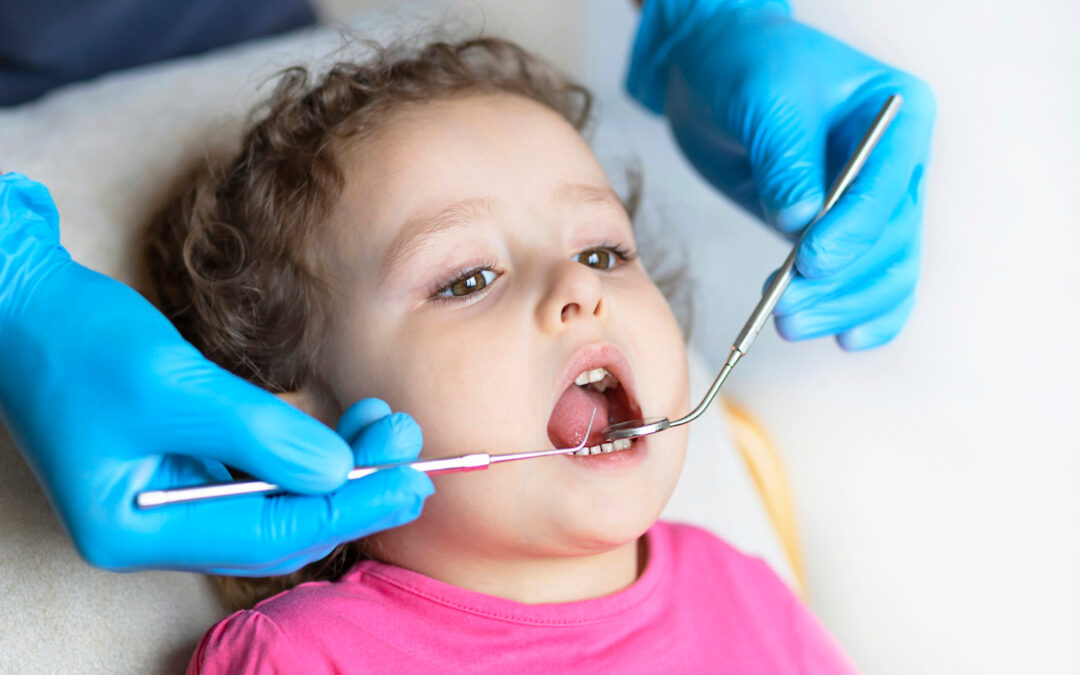 Cure dentistiche in anestesia totale in bambini molto piccoli a Milano, Roma e Torino